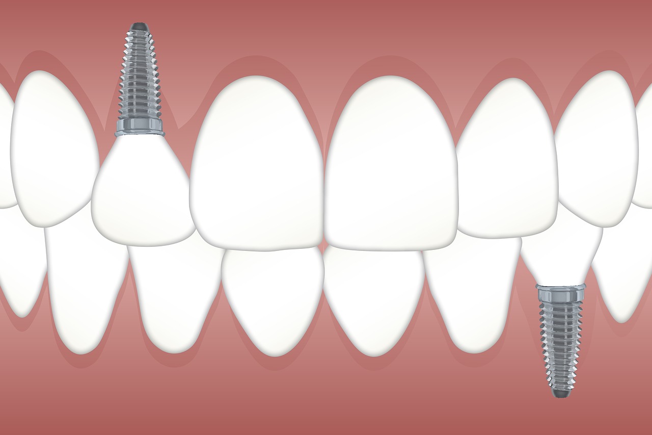 teeth